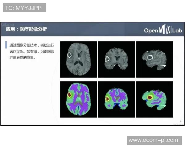 成都排球队包夹战术解析与实战应用探讨